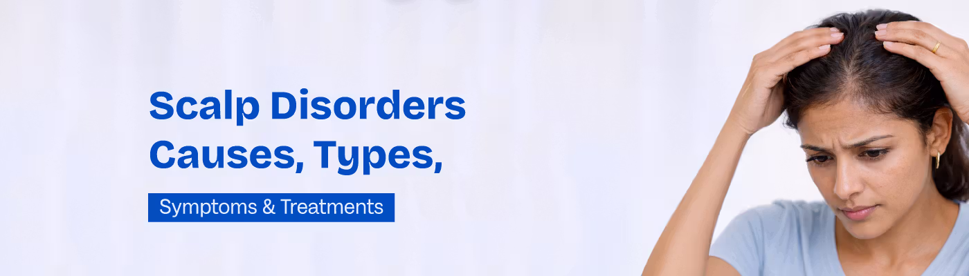 dandruff scalp condition 

